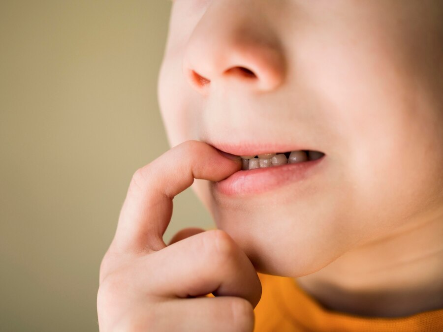 Налет на зубах у ребенка